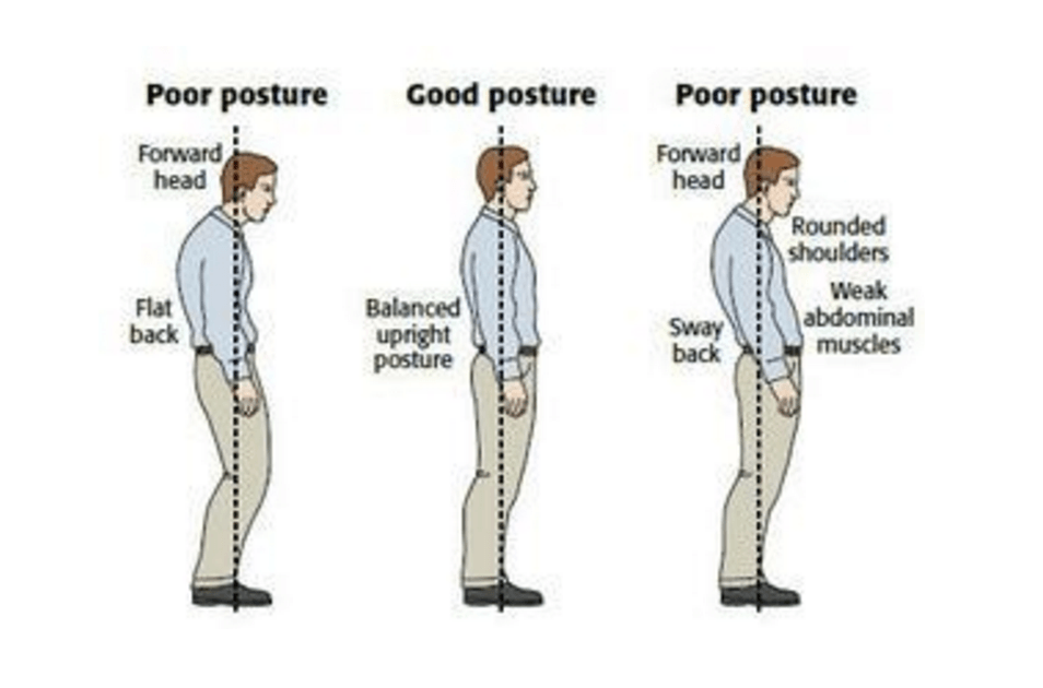 مصدر الصورة: http://www.thephysiocompany.com/blog/stop-slouching-postural-dysfunction-symptoms-causes-and-treatment-of-bad-posture