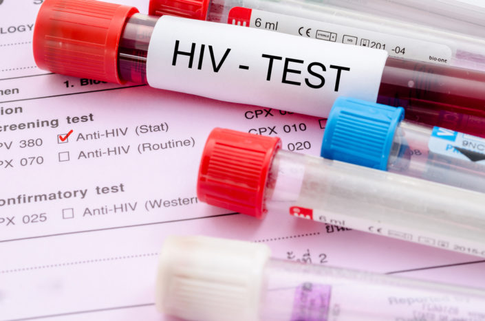اختبار فيروس نقص المناعة البشرية