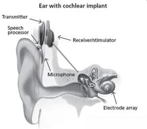 جهاز زراعة قوقعة الأذن