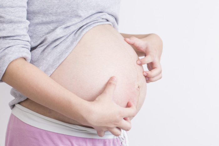 التهاب الجريبات الحكة هو سبب حكة الجلد أثناء الحمل