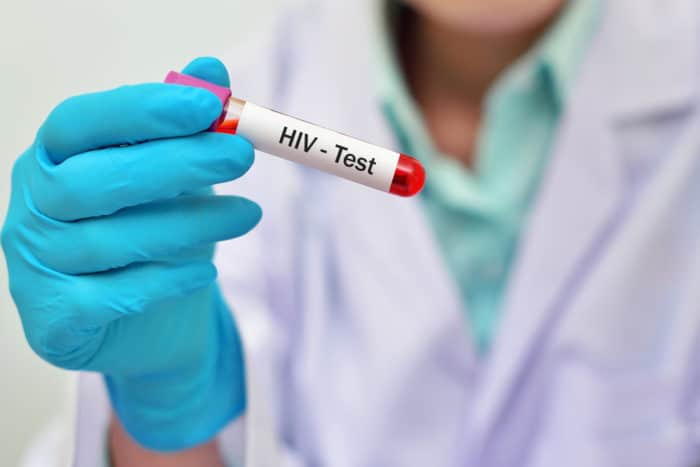اختبار فيروس نقص المناعة البشرية
